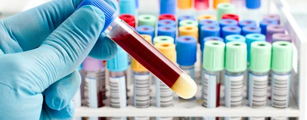 Как правильно подготовиться к сдаче анализов крови?