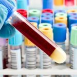 Как правильно подготовиться к сдаче анализов крови?